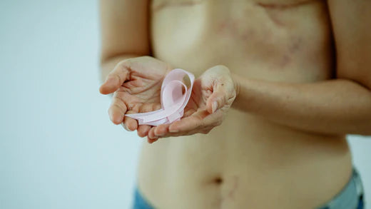 Le cause e le forme del tumore al seno: capire tutto per una migliore prevenzione
